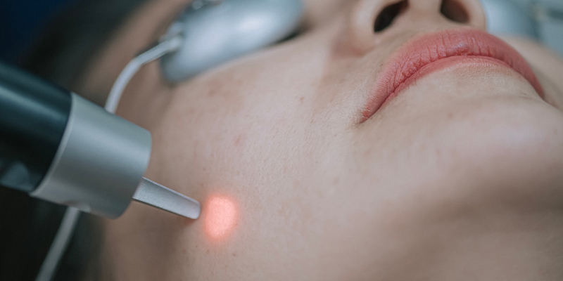Skin Tightening in Fort Myers, Florida