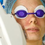 IPL Foto Facial
