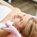 Microneedling