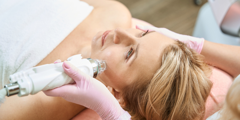 Microneedling in Fort Myers, Florida