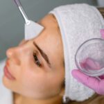 Chemical Peels
