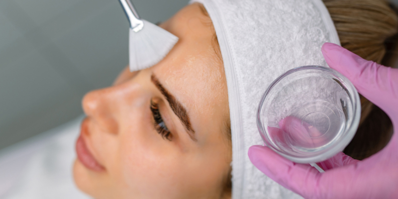 Chemical Peels in Fort Myers, Florida